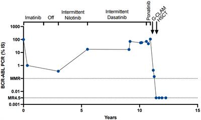 Case Report: ASXL1, RUNX1, and IDH1 mutation in tyrosine kinase-independent resistant chronic myeloid leukemia progressing to chronic myelomonocytic leukemia-like accelerated phase